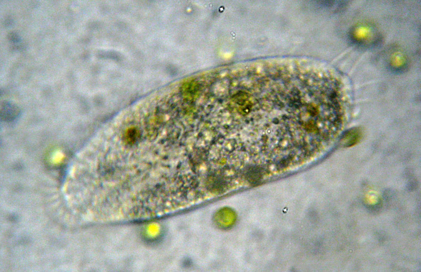 Tre Protozoi da identificare (se possibile)